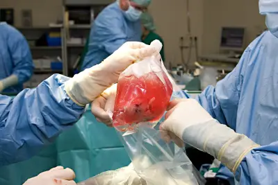 Organ donors’ lives endangered by rushed transplant procedures, investigation finds